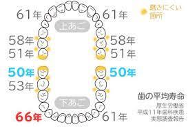 歯の寿命　　大阪市城東区の医療法人がもう四丁目