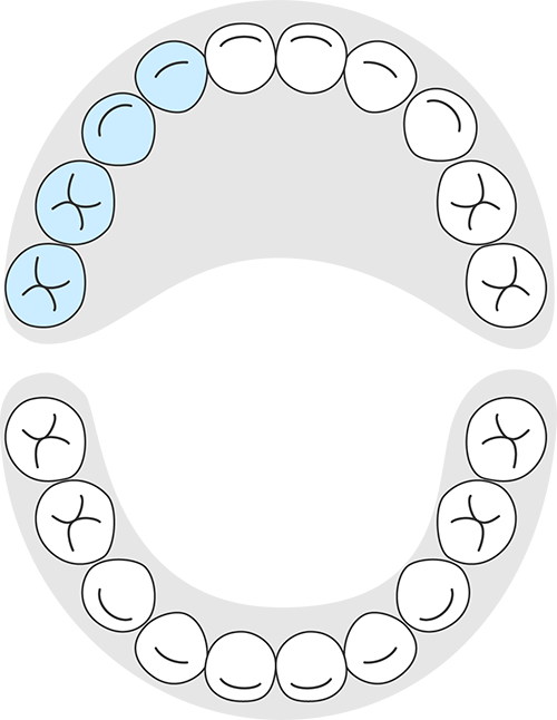 ブロック1