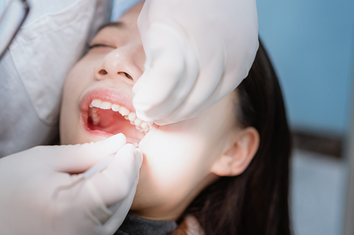 親知らずの抜歯の治療方法