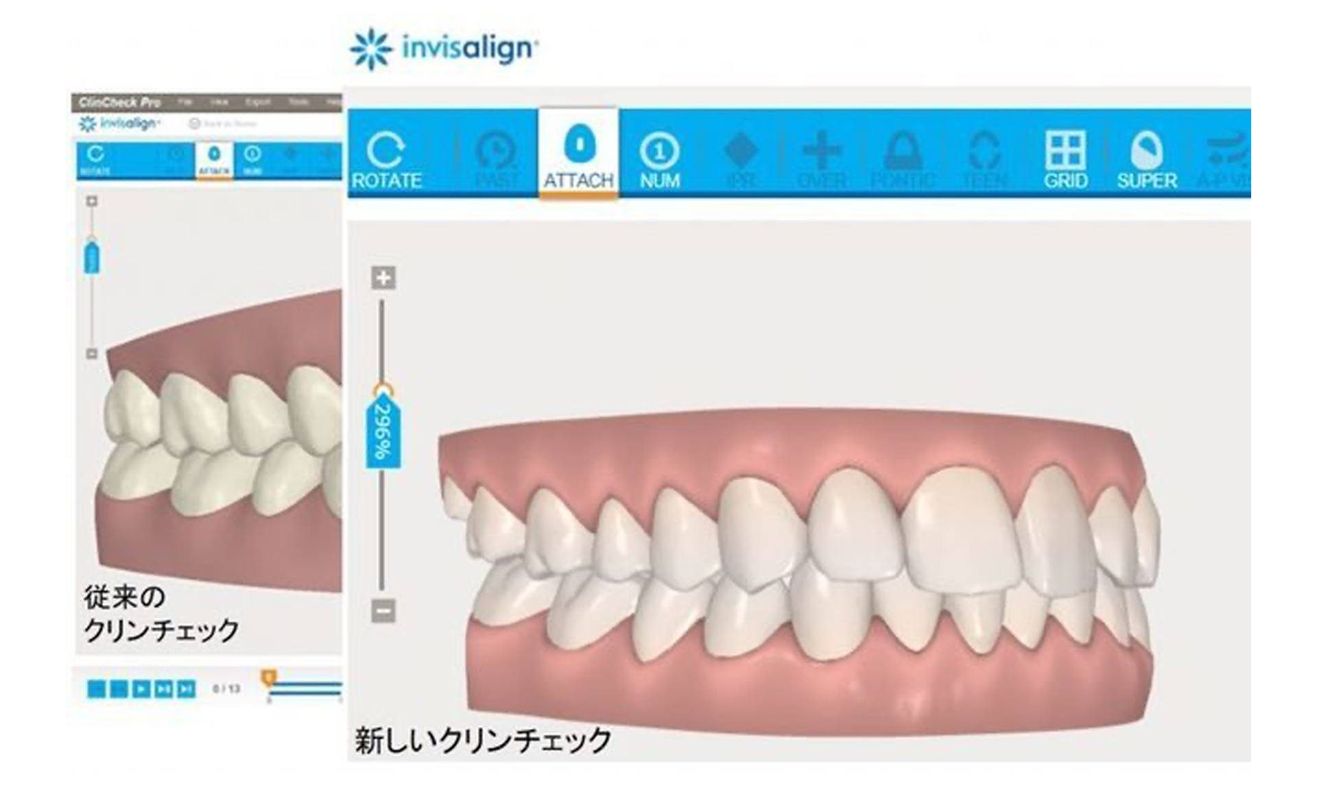 3Dで確認できる治療計画の立案